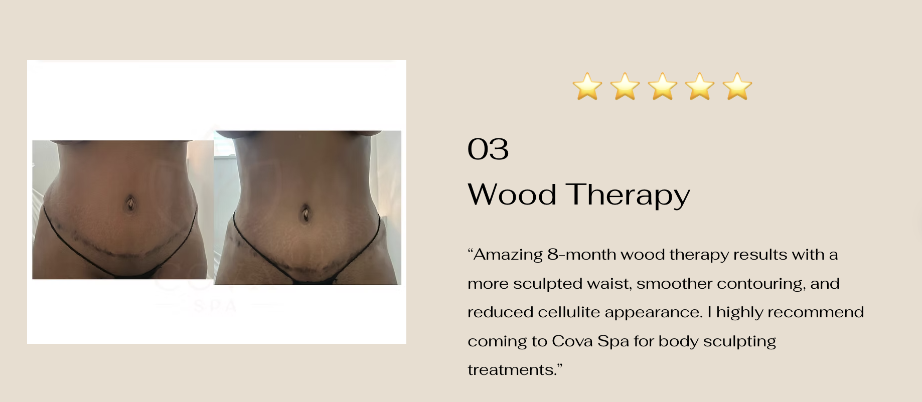 Wood Therapy body sculpting results — before and after at Cova Spa