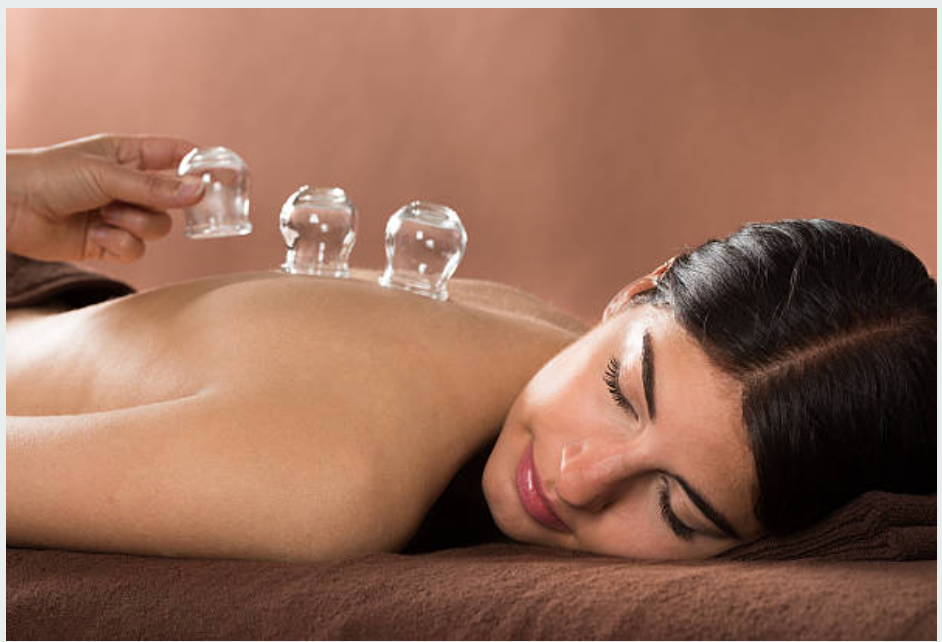 Revive cupping massage therapy at Cova Spa