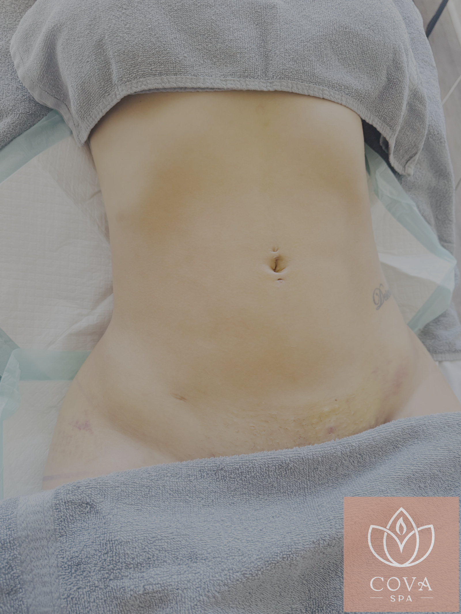 Post-surgical recovery results at Cova Spa
