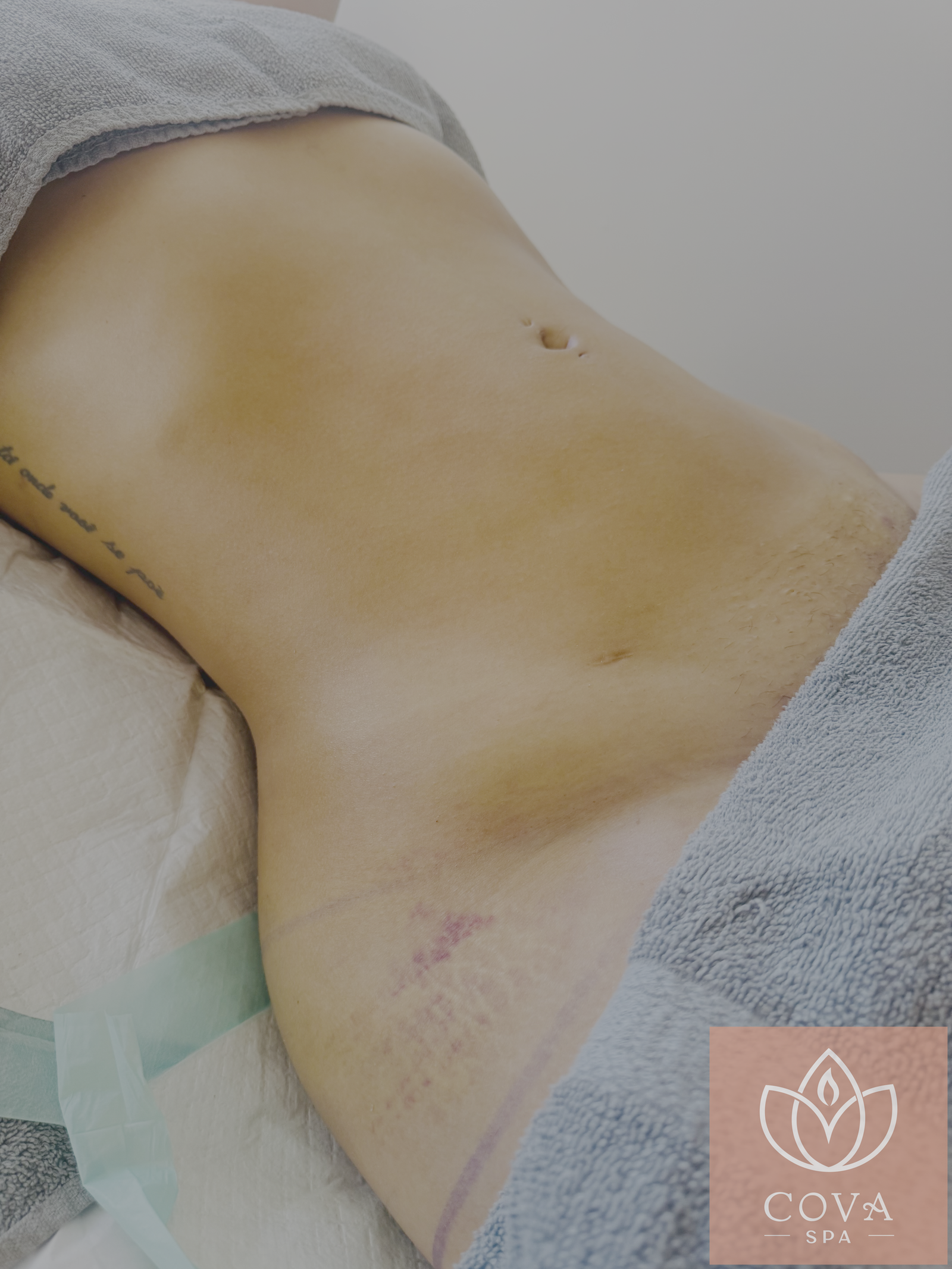 Post-surgical recovery results at Cova Spa